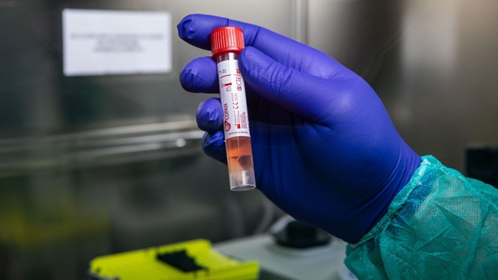 Majka i beba u Bijeljini nisu pozitivne na koronavirus