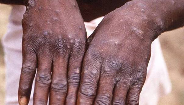 Majmunske boginje nastavile da se šire svijetom