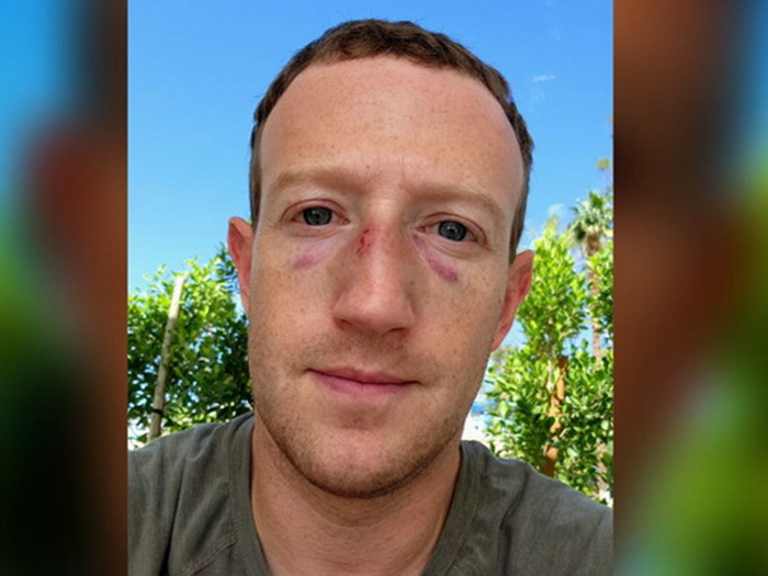 Mark Zuckerberg s povredom i masnicama ispod očiju