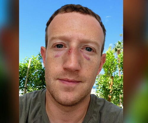 Mark Zuckerberg s povredom i masnicama ispod očiju