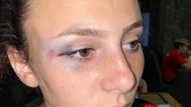 Masovna tučnjava nogometašica u Goraždu