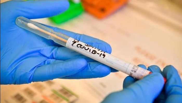 Matić: U SBŽ-u nema novih slučajeva zaraze koronavirusom