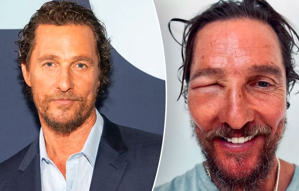 McConaughey pokazao kako izgleda 'bliski susret s pčelom'