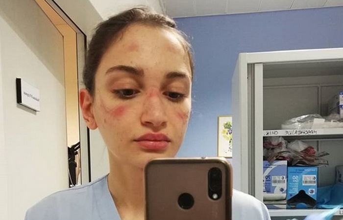 Medicinska sestra iz Italije objavila selfie s posla, pogledajte joj lice