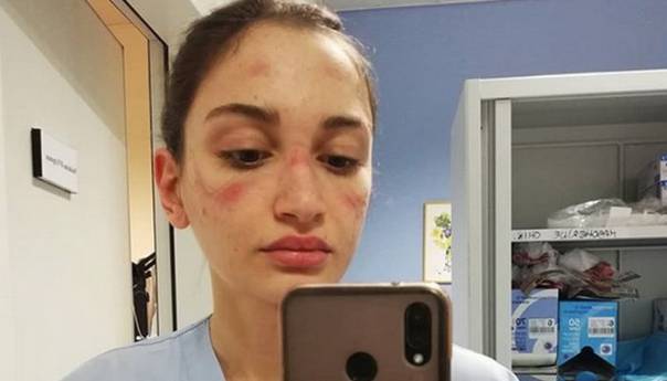 Medicinska sestra iz Italije objavila selfie s posla, pogledajte joj lice