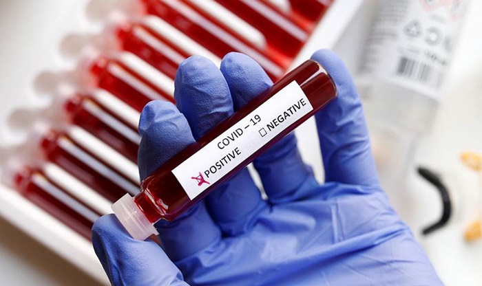 Medicinska sestra, koja je radila u karantinu u Bijeljini, zaražena koronavirusom