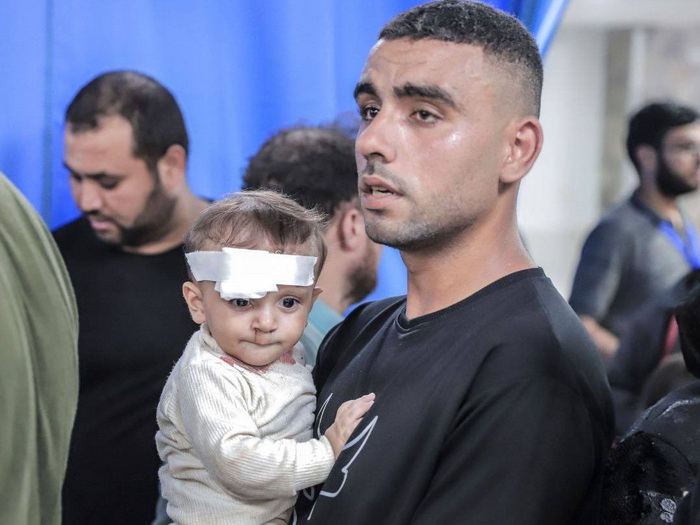 Ministarstvo zdravlja: U Gazi ubijeno 2700 djece