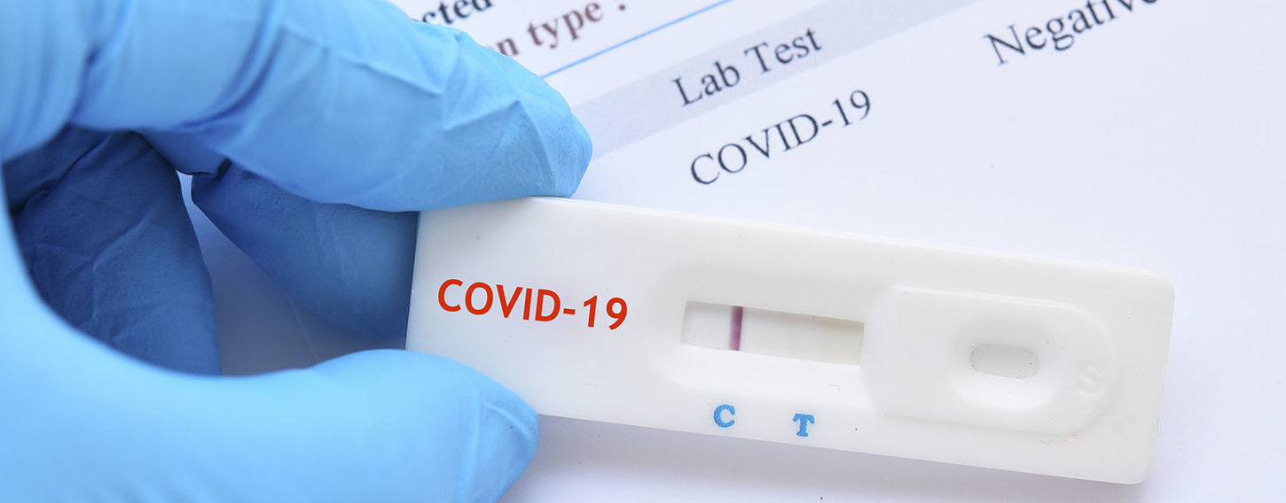 Ministarstvo zdravstva i Zavod za javno zdravstvo KS obezbijedili 8.000 antigen testova