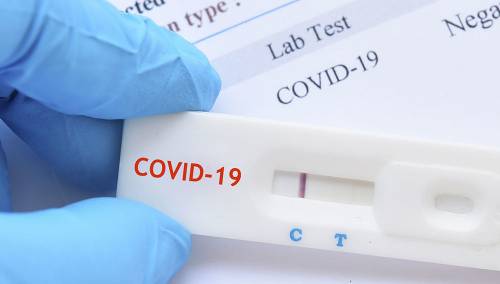 Ministarstvo zdravstva i Zavod za javno zdravstvo KS obezbijedili 8.000 antigen testova