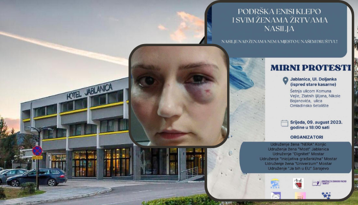Mirni protest u znak podrške pretučenoj radnici iz Jablanice