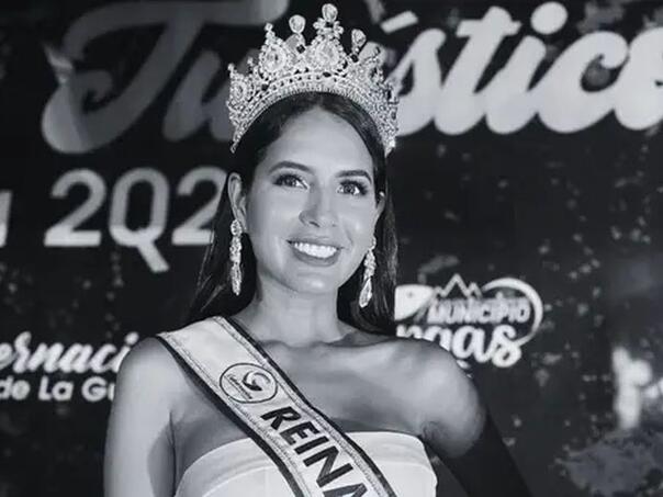 Misica iz Venecuele preminula nakon rutinske operacije lica