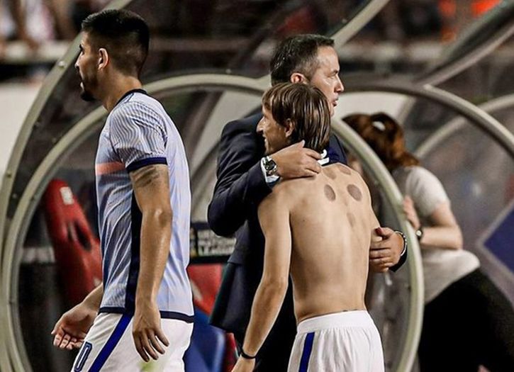 Modrić se skinuo i na tijelu pokazao tragove drevne islamske terapije hidžame