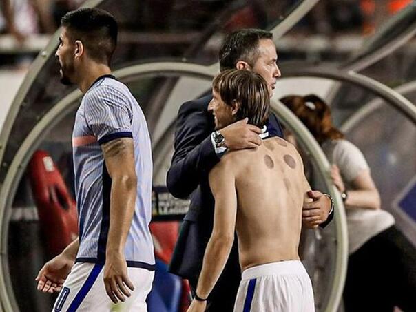 Modrić se skinuo i na tijelu pokazao tragove drevne islamske terapije hidžame