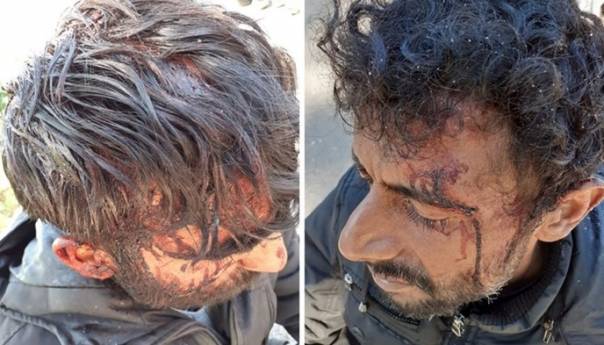 MUP RH o mučenju migranata: Možda su se međusobno obračunali