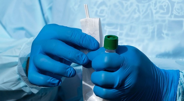 Na području Brčkog još jedna osoba zaražena koronavirusom