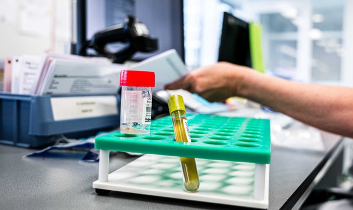 Na području Tuzle nema potvrđenih slučajeva infekcije od koronavirusa