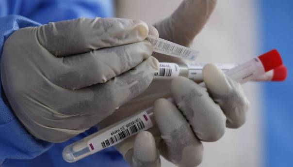 Na prijelazima Vardište i Popovi otkriveni falsificirani PCR testovi