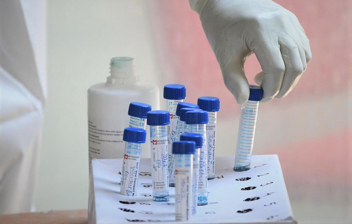 Na srbijanskom portalu eUprava zakazivanje za PCR test na osobni zahtjev