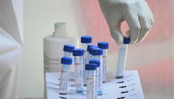 Na srbijanskom portalu eUprava zakazivanje za PCR test na osobni zahtjev