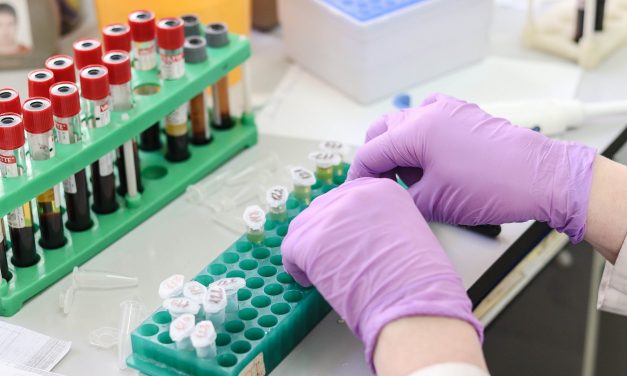 Nagli skok novozaraženih u Srbiji - jučer 48, danas 96