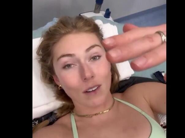 Najbolja svjetska skijašica nakon strašnog pada: Ne mogu se pomaknuti