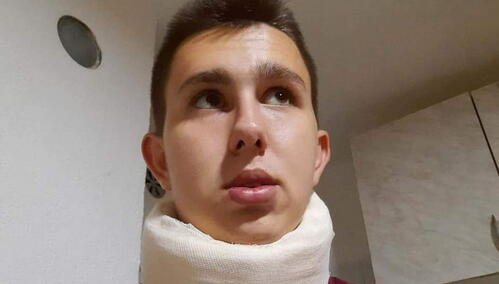 Napadnut bošnjački povratnik u Bratuncu, stižu reakcije