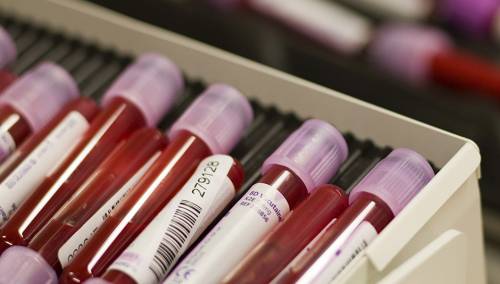 Napori za eliminaciji hepatitisa usporeni tokom pandemije