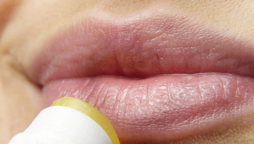 Naučnici otkrili: Zašto se herpes uvijek vraća?