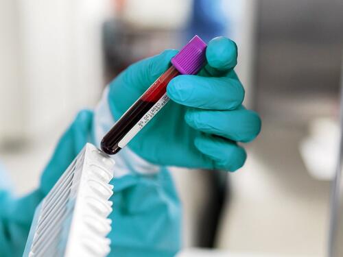 Nauka na pragu čuda: Novi test otkriva rak prije simptoma!?