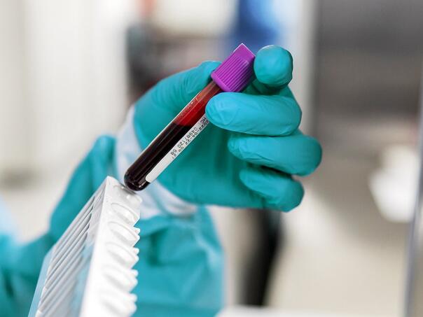 Nauka na pragu čuda: Novi test otkriva rak prije simptoma!?