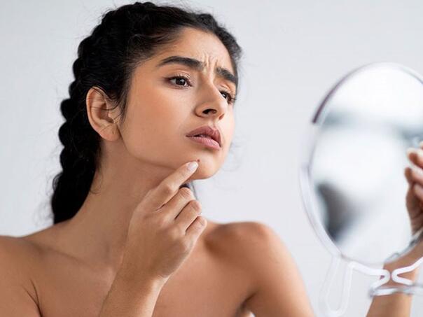 Navika ili poremećaj: Kada diranje kože postaje ozbiljan problem