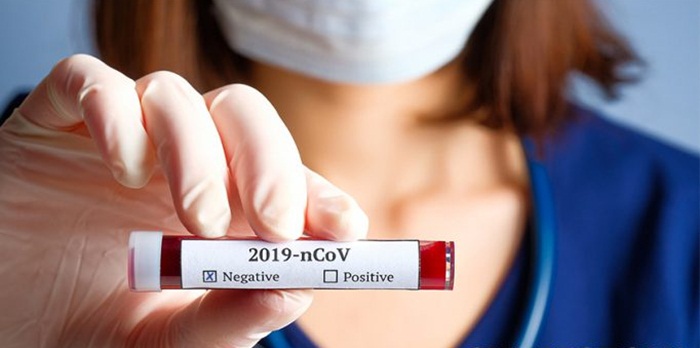 Negativni nalazi testiranih Bugojanaca, radnici HES-a na terenu