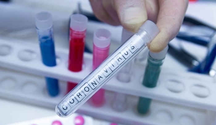 Negativni svi uzorci testirani u RS na virus korona