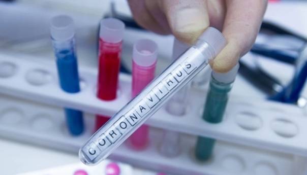 Negativni svi uzorci testirani u RS na virus korona