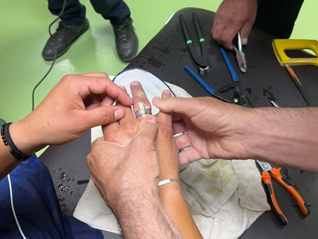 Neobična intervencija: Vatrogasci u Prijedoru skidali prsten s ruke