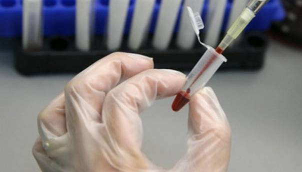 Ništa od vakcine protiv HIV-a, naučnici odustali