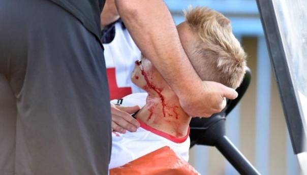 Nogometašu u Hrvatskoj pukla vilica na utakmici