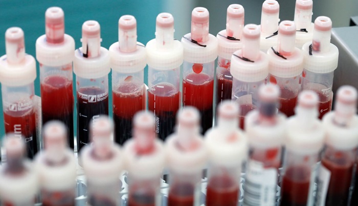 Nova 24 slučaja koronavirusa u FBiH