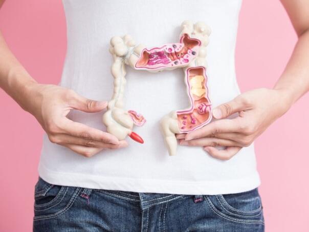 Nova metoda otkrivanja raka debelog crijeva tačna u više od 90 posto slučajeva