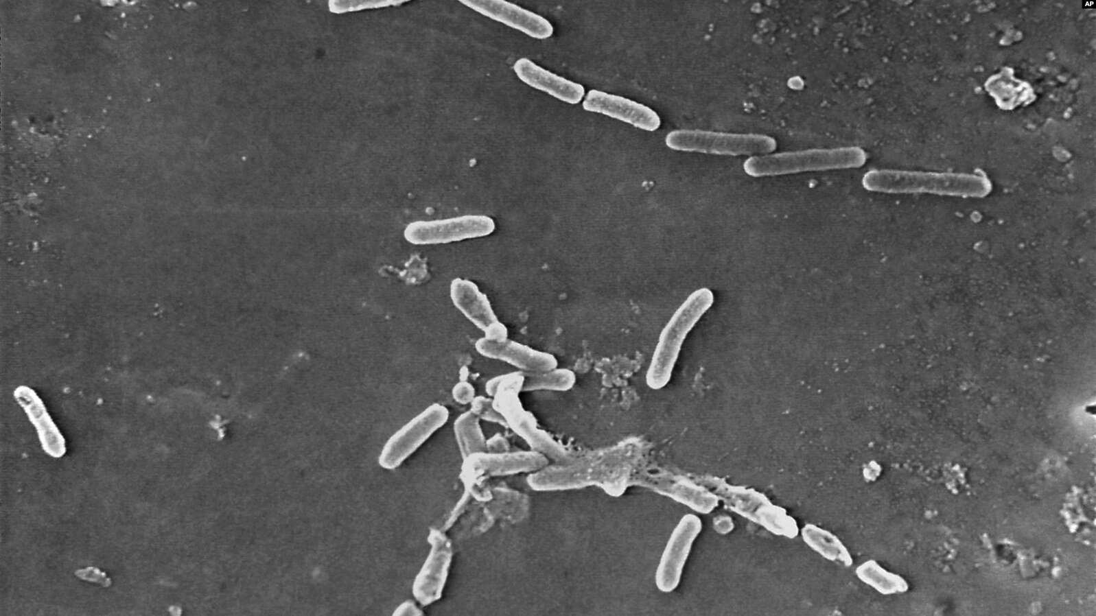 Novi antibiotik razlikuje dobre od loših bakterija