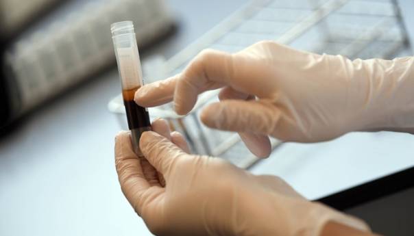 Novi slučaj korona virusa u HNK, zaražen pacijent iz Čitluka