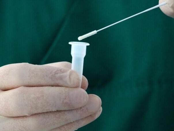 Novi soj korona virusa, evo koje simptome izaziva