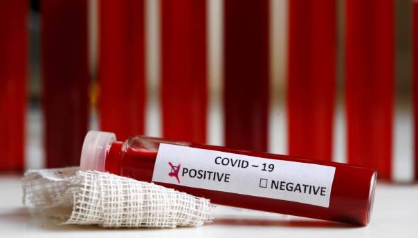Novih 14 slučajeva koronavirusa u Crnoj Gori