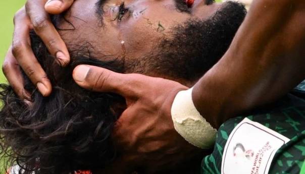 Objavljen rendgenski snimak teško povrijeđenog Saudijca