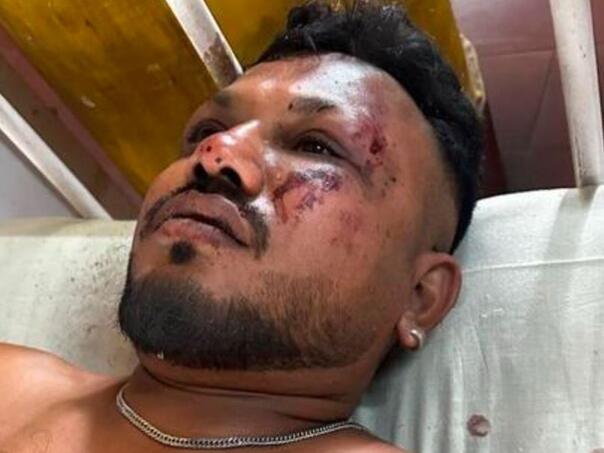 Objavljena fotografija čovjeka koji je preživio pad aviona: Čuo sam glasan zvuk...