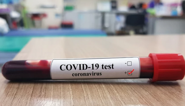 Obustava nastave u školama i fakultetima Posavske županije