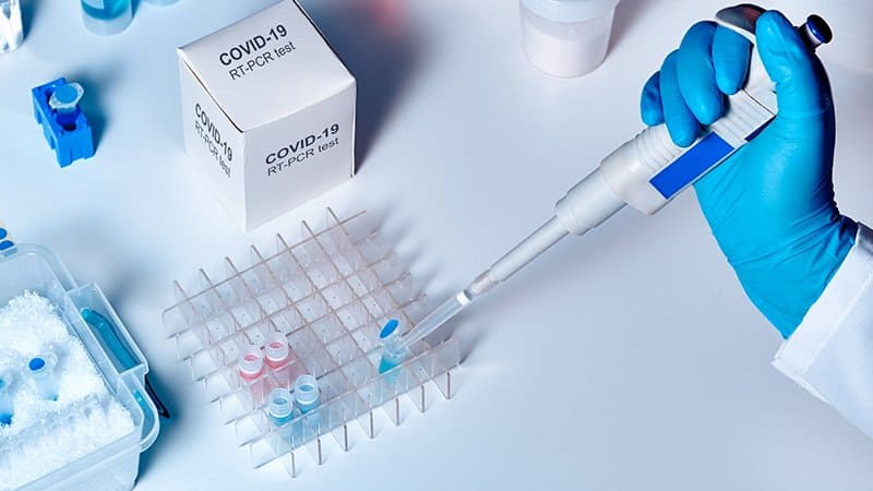 Od ponedjeljka PCR testiranje koštaće 105 KM