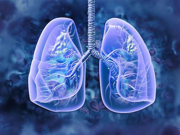 Odobren lijek za uznapredovali najčešći rak pluća