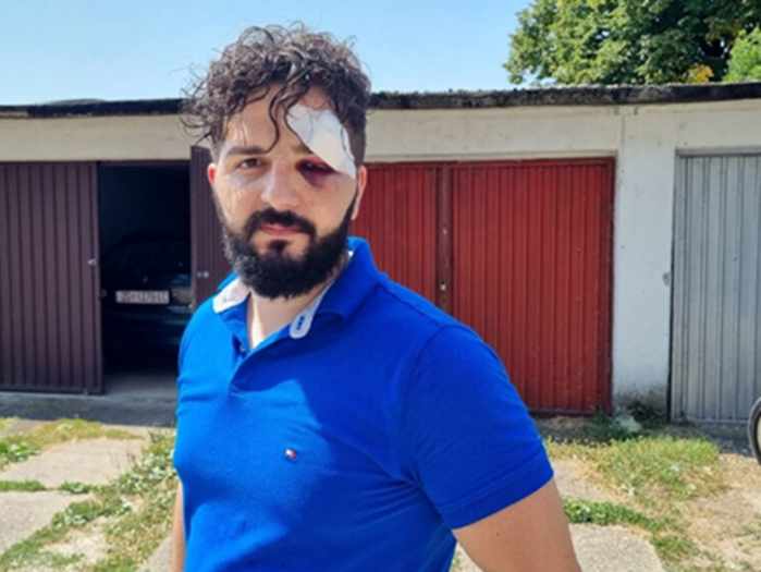 Oglasili se iz policije o napadu na novinara Mirzu Derviševića