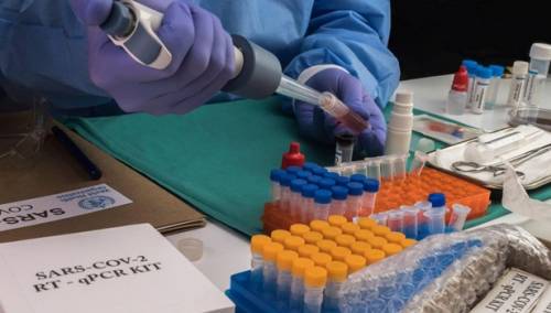 Oko 1.500 dobrovoljaca biće namjerno zaraženo kako bi testirali vakcinu